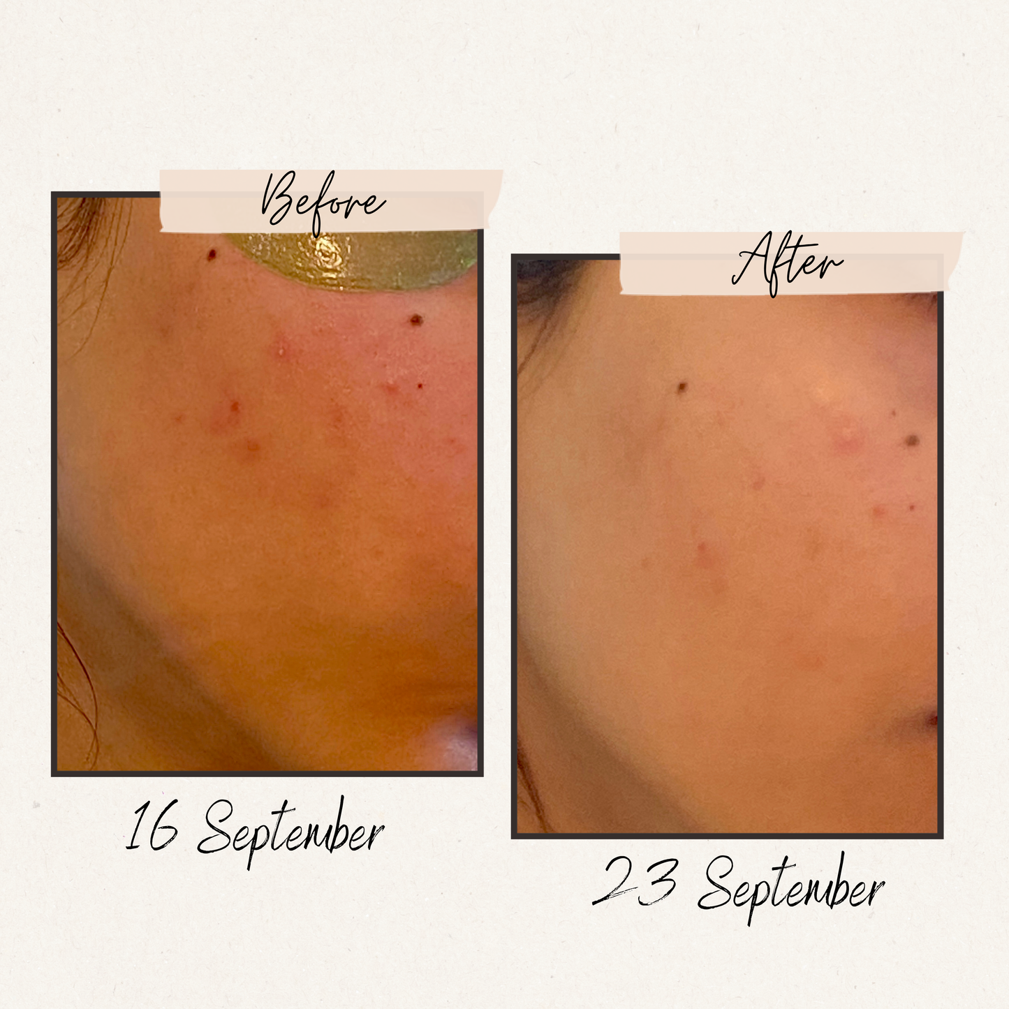 Marino Oil – Essential Clarity Oil