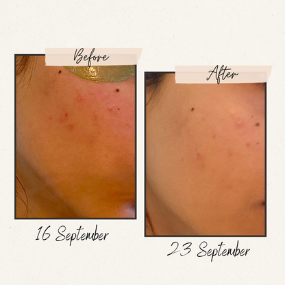 Marino Oil – Essential Clarity Oil